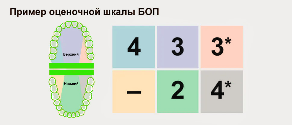 Скрининг на наличие заболеваний тканей пародонта с проведением БОП