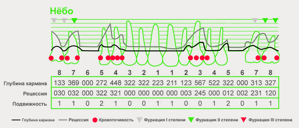 Подробная пародонтологическая карта