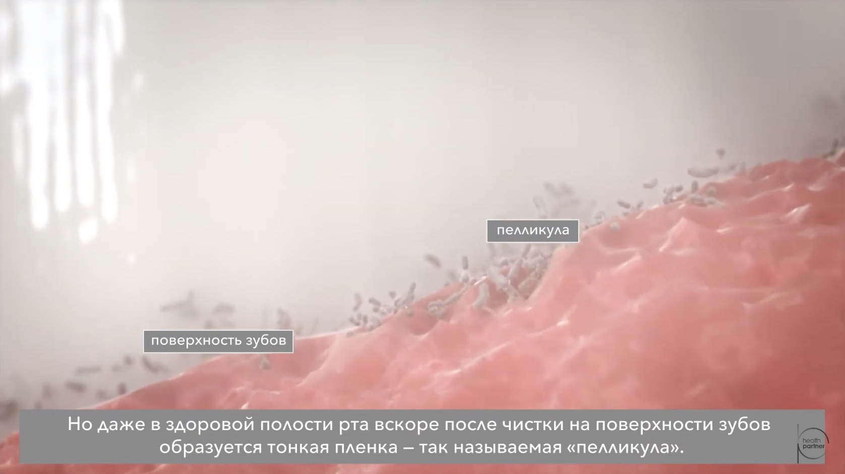Основным этиологическим фактором развития заболеваний пародонта является инфекция (бактерии зубного налета)1–4