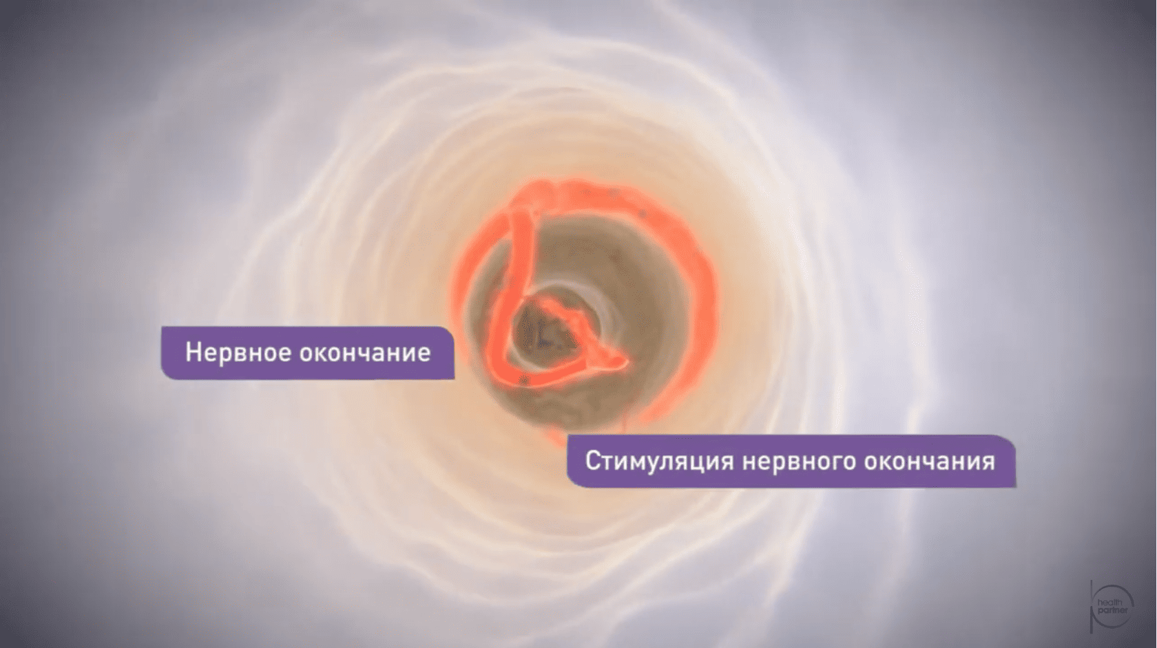 Гидродинамическая теория развития гиперчувствительности дентина